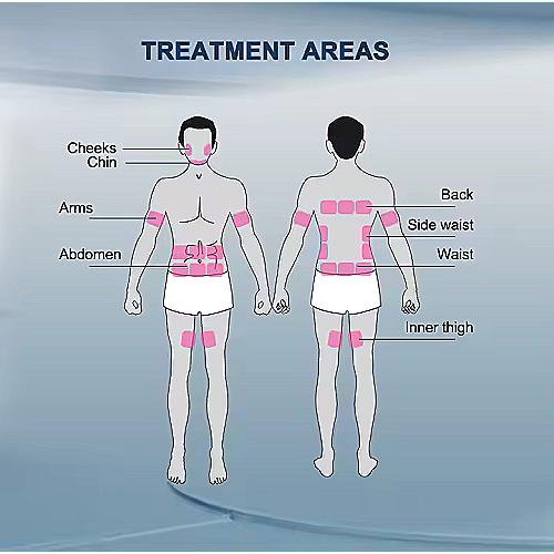 Delux TrueRF profesionalni RF i EMS uređaj za oblikovanje tijela